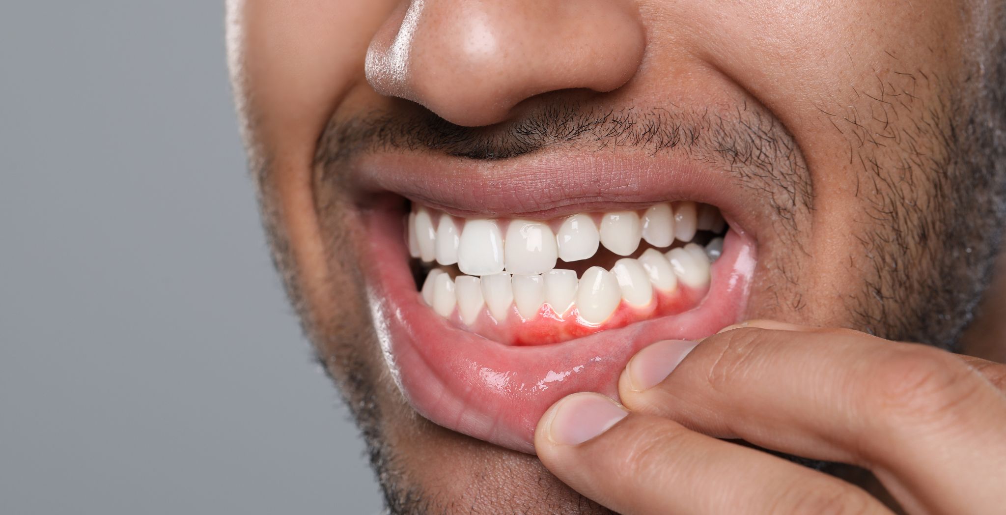 gum recession treatment options, gum recession treatment at dentist, best gum recession treatment, non-surgical gum recession treatment, surgical gum recession treatment, gum recession treatment for sensitive teeth, advanced gum recession treatment,