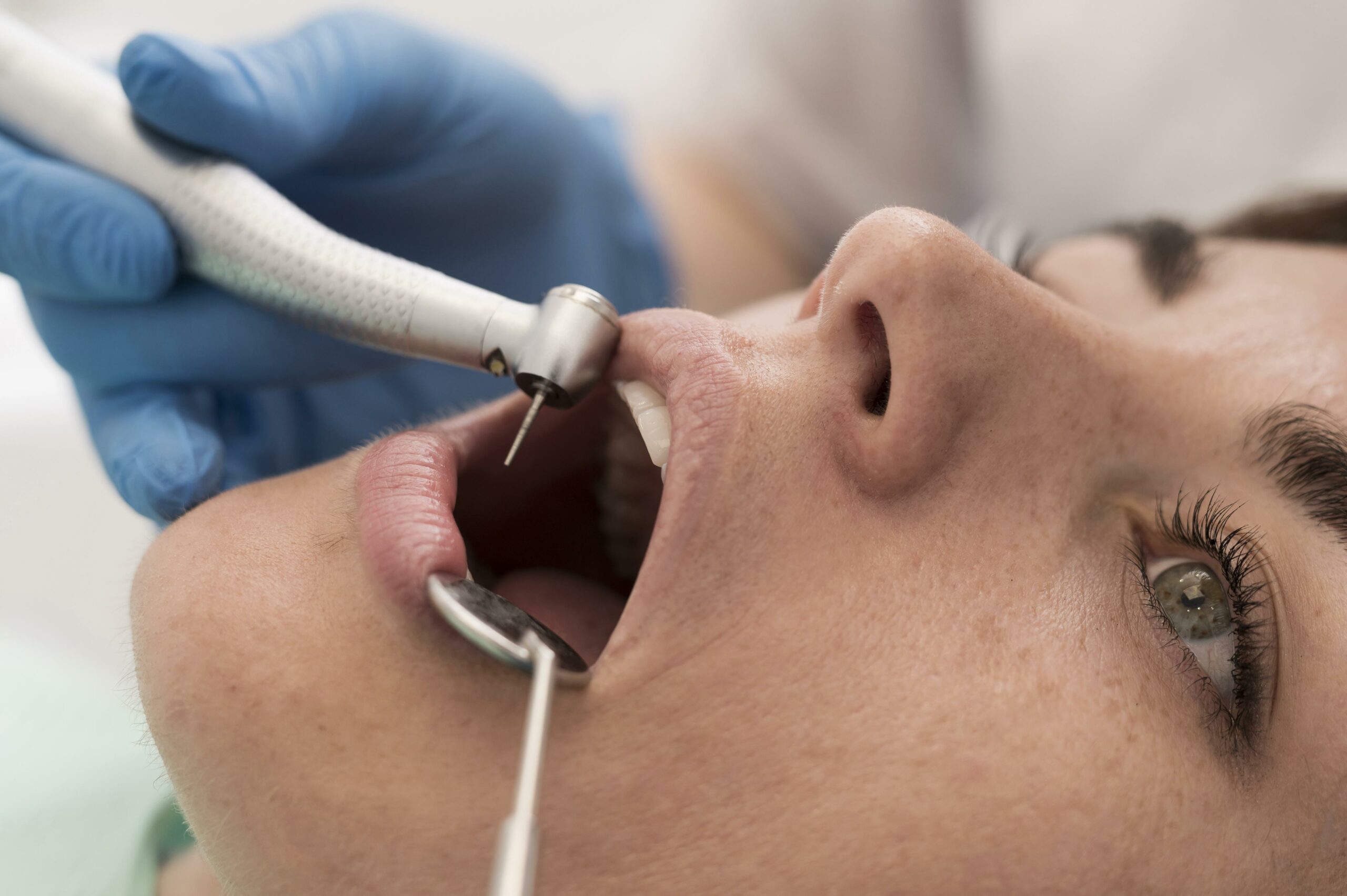 Root canal steps, Root canal procedure stages, Steps in root canal treatment, Root canal therapy process, Endodontic treatment steps, Root canal cleaning and filling, How a root canal is done